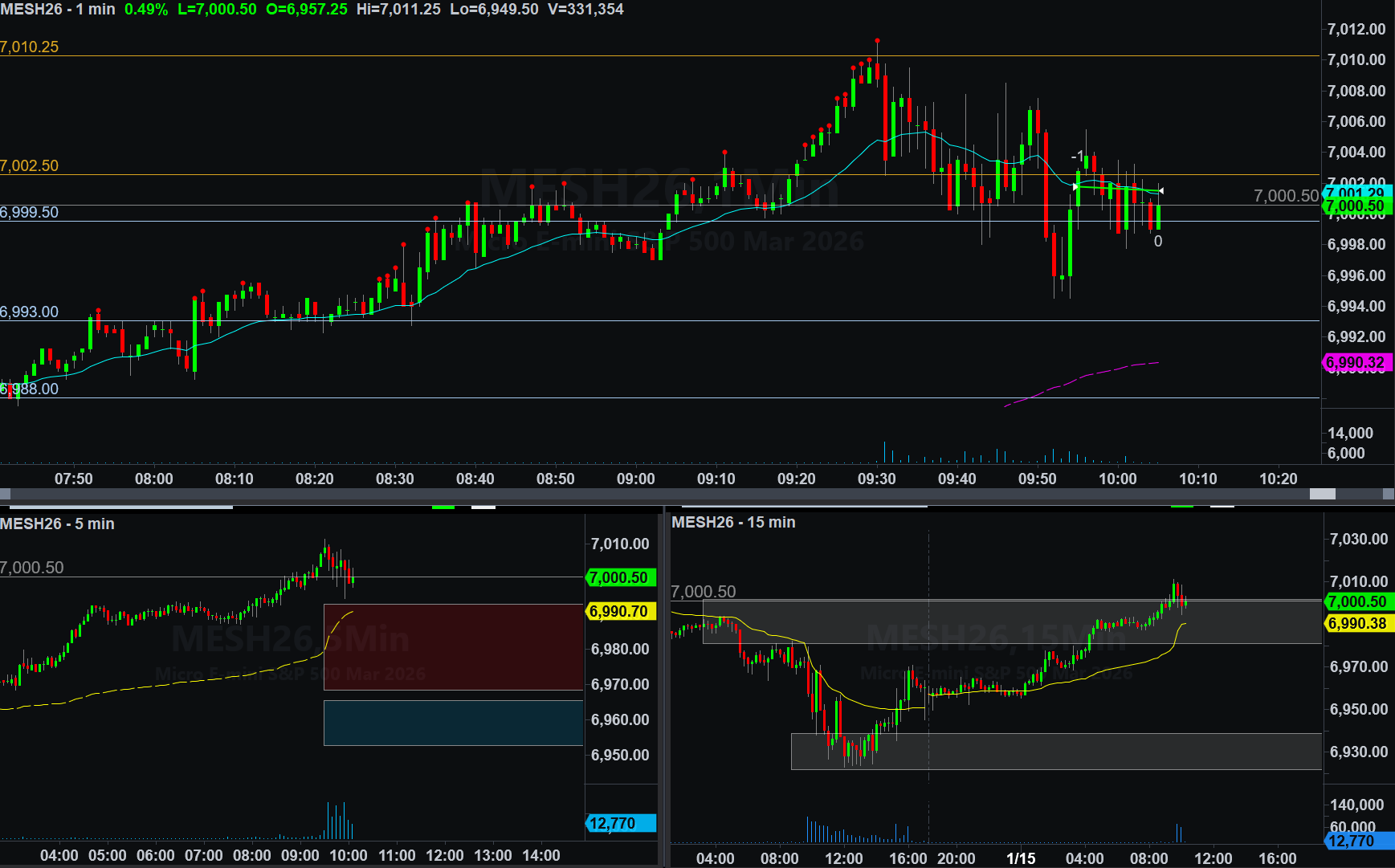 January 15, 2026 (-$21.25) - Trader Rehab