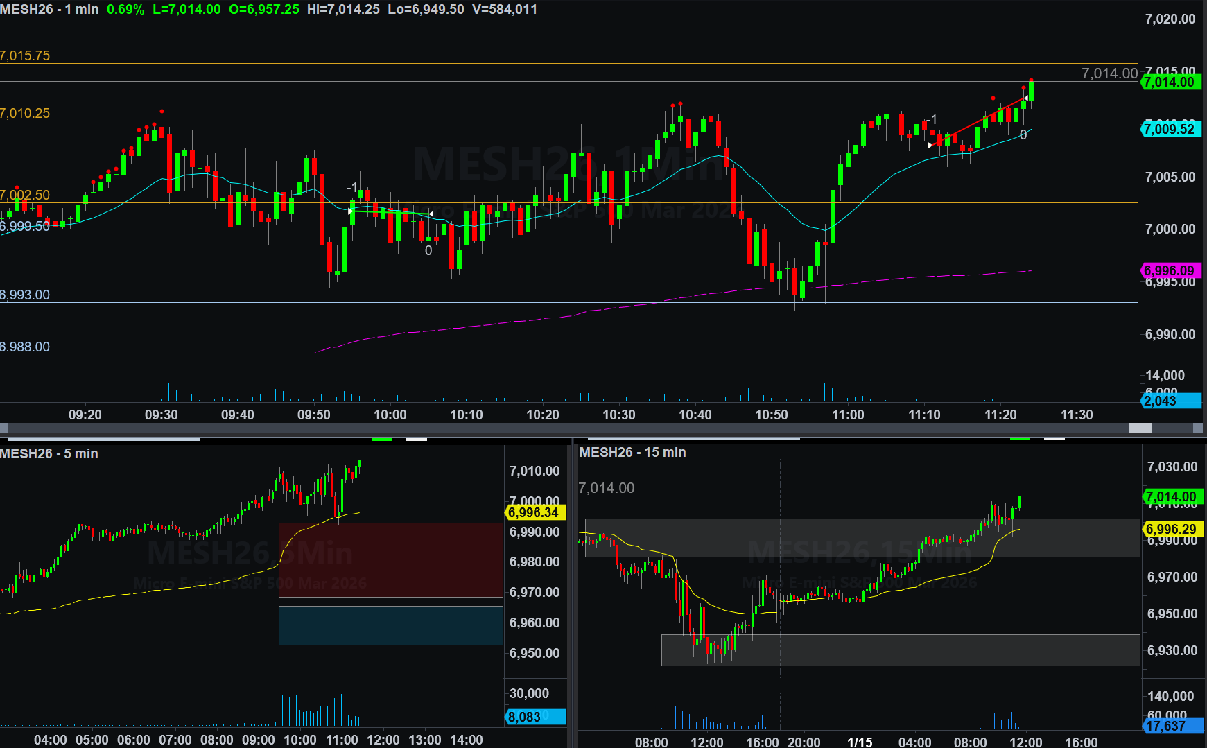 January 15, 2026 (-$21.25) - Trader Rehab