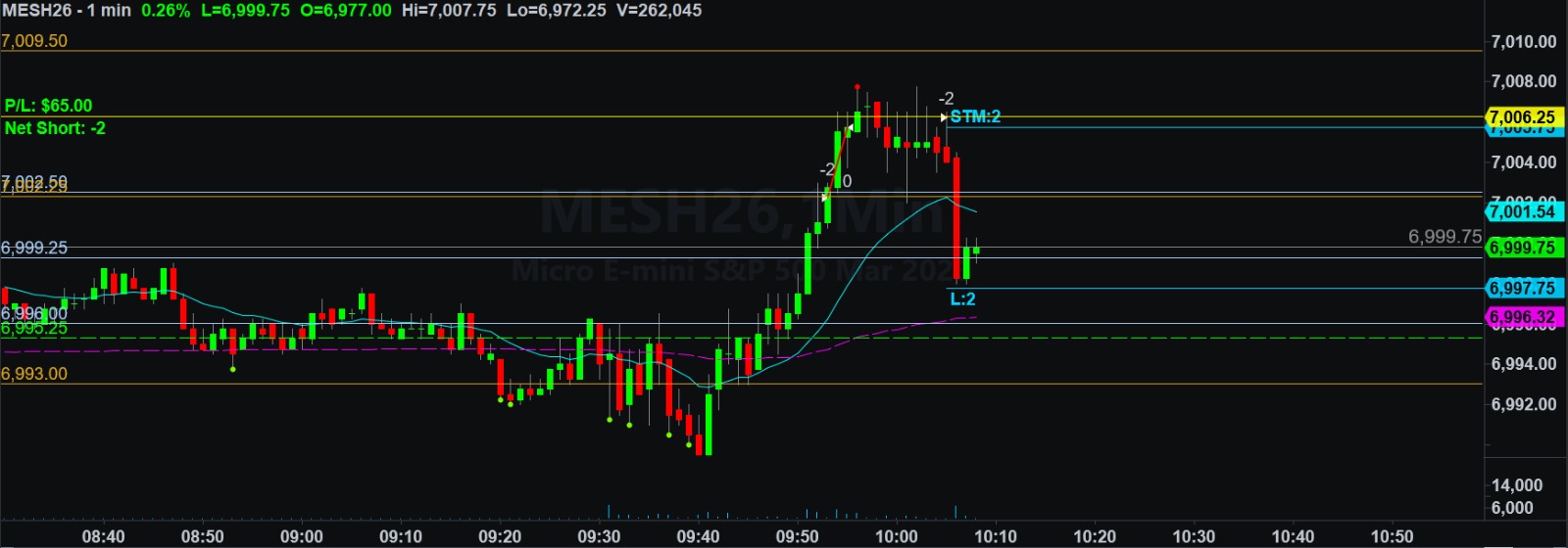 January 27, 2026 (-$32.50) | Take Profit Missed To The Tick